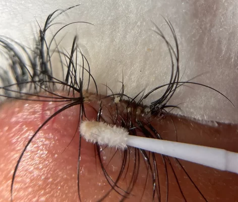 Eyelash professional deep cleaning removing excess sebum at MLashes Brisbane